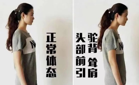 身材好不止是瘦，瑜伽教练-体态改善型锻炼才是关键！